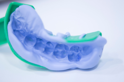 當確立了治療方案，牙醫會幫你印牙模，並以數碼化軟件，預測植牙的位置及植體大小，製作手術導航器 (SURGICAL GUIDE)。