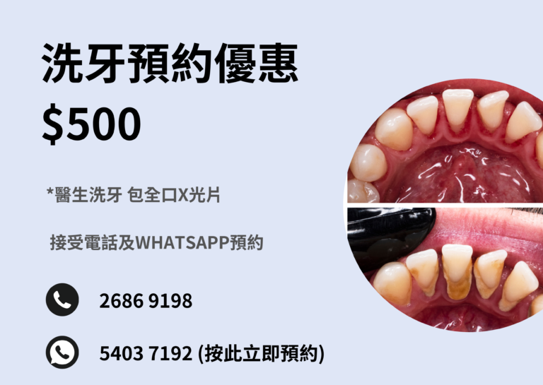 洗牙預約優惠，價錢$500 ，屯門天水圍牙醫，服務包括醫生洗牙及全口X光片，接受電話及WhatsApp預約