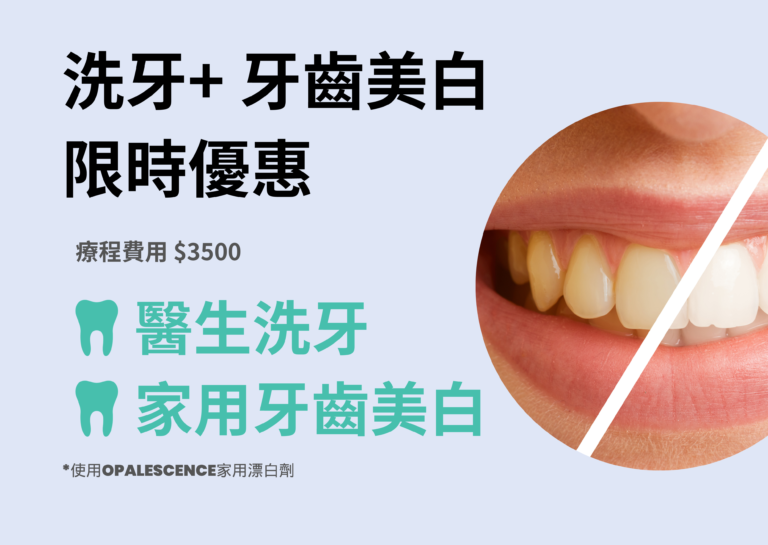 洗牙及牙齒美白限時優惠，療程費用$3500 ，元朗牙醫洗牙家用牙齒美白屯門天水圍牙醫