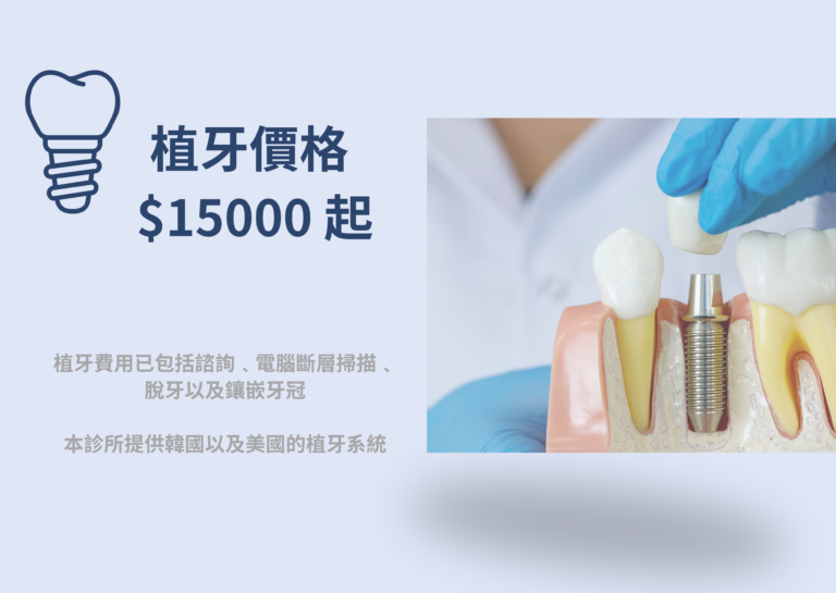 元朗牙醫植牙服務, 植牙價錢15,000起, 植牙費用已包括資訊, 電腦斷層掃描, 脫牙及鑲嵌牙官 脫牙及鑲嵌牙冠, 本診所提供美國及韓國的植牙技術,屯門天水圍牙醫